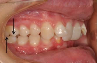 Oralsurgery